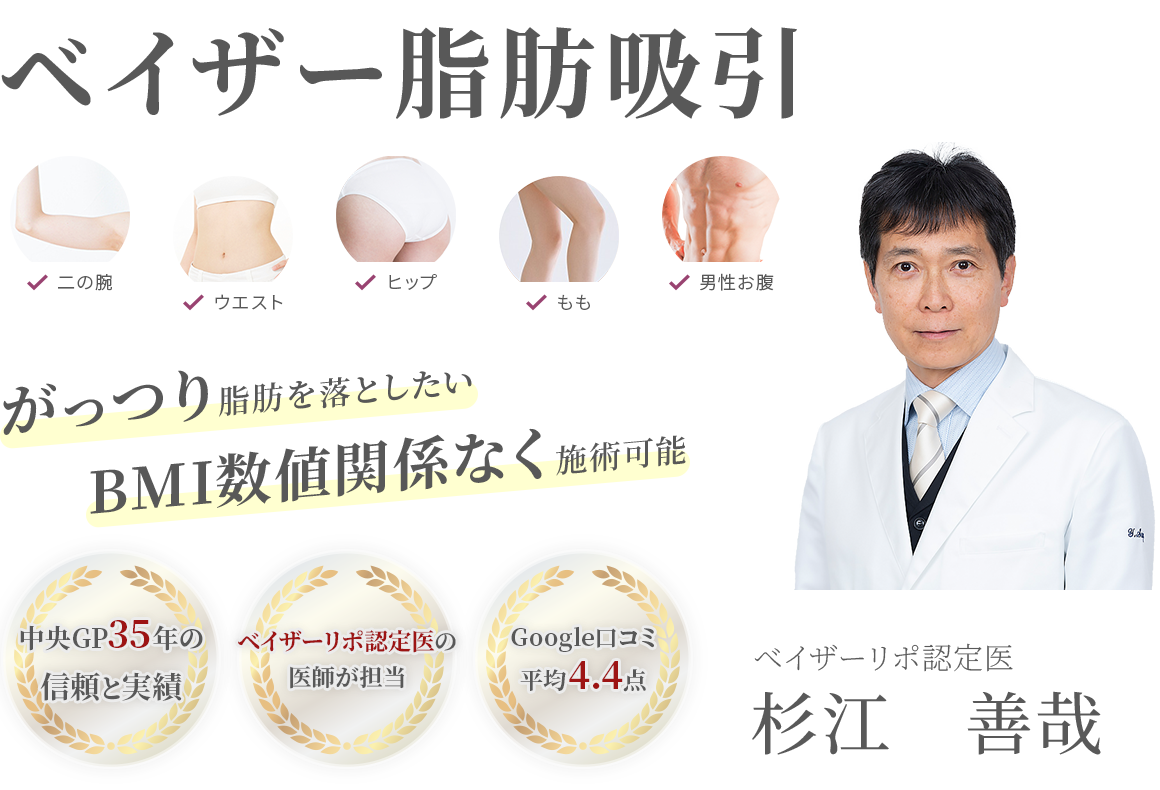 ベイザー脂肪吸引